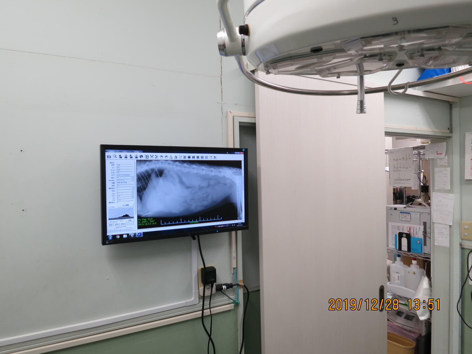 デジタルレントゲン